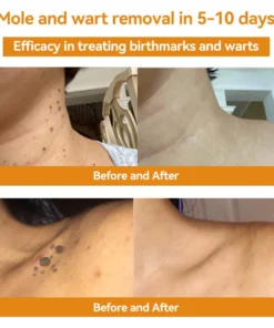 𝑇𝑢𝑟𝑜𝑛𝑢™ Bee Venom Skin Treatment Cream