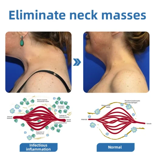 𝐌𝐫𝐞𝐒𝐢𝐨™ 𝗣𝗼𝗿𝘁𝗮𝗯𝗹𝗲 𝗟𝘆𝗺𝗽𝗵𝗮𝘁𝗶𝗰 𝗦𝗼𝗼𝘁𝗵𝗶𝗻𝗴 𝗕𝗼𝗱𝘆 𝗦𝗵𝗮𝗽𝗶𝗻𝗴 𝗨𝗹𝘁𝗿𝗮𝘀𝗼𝘂𝗻𝗱 𝗜𝗻𝘀𝘁𝗿𝘂𝗺𝗲𝗻𝘁 𝗳𝗼𝗿 𝗡𝗲𝗰𝗸