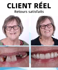 𝐁𝐢𝐤𝐞𝐧𝐝𝐚™ 𝗘𝗻𝘀𝗲𝗺𝗯𝗹𝗲 𝗱𝗲 𝗽𝗿𝗼𝘁𝗵è𝘀𝗲𝘀 𝗱𝗲𝗻𝘁𝗮𝗶𝗿𝗲𝘀 𝗮𝘃𝗲𝗰 𝗱𝗼𝘂𝗯𝗹𝘂𝗿𝗲 𝗲𝗻 𝘀𝗶𝗹𝗶𝗰𝗼𝗻𝗲