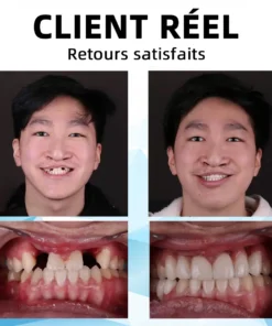 𝐁𝐢𝐤𝐞𝐧𝐝𝐚™ 𝗘𝗻𝘀𝗲𝗺𝗯𝗹𝗲 𝗱𝗲 𝗽𝗿𝗼𝘁𝗵è𝘀𝗲𝘀 𝗱𝗲𝗻𝘁𝗮𝗶𝗿𝗲𝘀 𝗮𝘃𝗲𝗰 𝗱𝗼𝘂𝗯𝗹𝘂𝗿𝗲 𝗲𝗻 𝘀𝗶𝗹𝗶𝗰𝗼𝗻𝗲