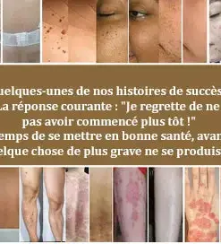 𝑇𝑢𝑟𝑜𝑛𝑢™ 𝐂𝐫è𝐦𝐞 𝐝𝐞 𝐭𝐫𝐚𝐢𝐭𝐞𝐦𝐞𝐧𝐭 𝐜𝐮𝐭𝐚𝐧é 𝐚𝐮 𝐯𝐞𝐧𝐢𝐧 𝐝'𝐚𝐛𝐞𝐢𝐥𝐥𝐞