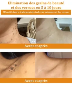 𝑇𝑢𝑟𝑜𝑛𝑢™ 𝐂𝐫è𝐦𝐞 𝐝𝐞 𝐭𝐫𝐚𝐢𝐭𝐞𝐦𝐞𝐧𝐭 𝐜𝐮𝐭𝐚𝐧é 𝐚𝐮 𝐯𝐞𝐧𝐢𝐧 𝐝'𝐚𝐛𝐞𝐢𝐥𝐥𝐞