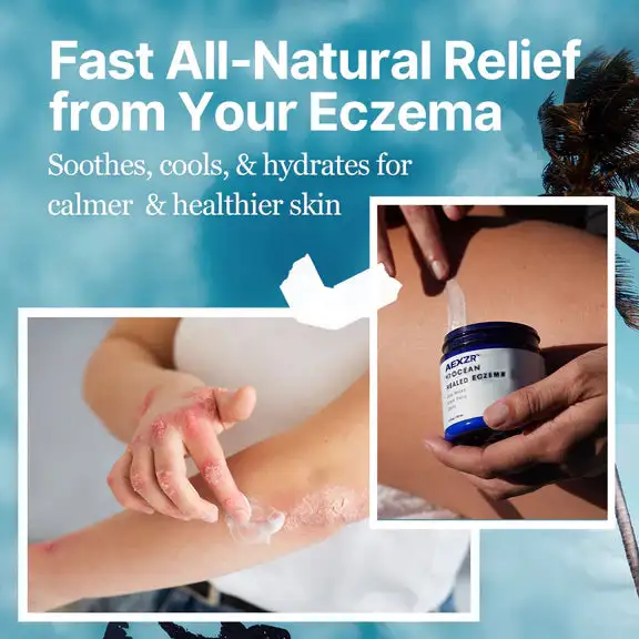 AEXZR™ Ocean Healed Eczema Soothing Cream
