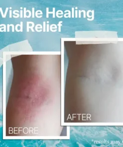 AEXZR™ Ocean Healed Eczema Soothing Cream