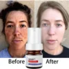 AEXZR™ Vitamin C Whitening Freckles Face Cream Remove Melasma Dark Spots Lighten Melanin