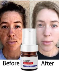 AEXZR™ Vitamin C Whitening Freckles Face Cream Remove Melasma Dark Spots Lighten Melanin