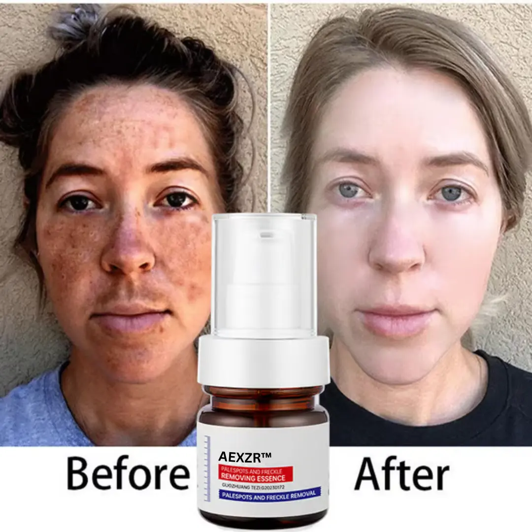 AEXZR™ Vitamin C Whitening Freckles Face Cream Remove Melasma Dark Spots Lighten Melanin
