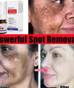AEXZR™ Vitamin C Whitening Freckles Face Cream Remove Melasma Dark Spots Lighten Melanin