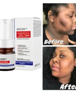 AEXZR™ Vitamin C Whitening Freckles Face Cream Remove Melasma Dark Spots Lighten Melanin