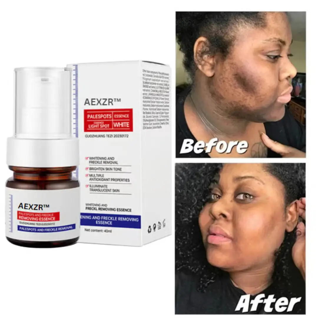 AEXZR™ Vitamin C Whitening Freckles Face Cream Remove Melasma Dark Spots Lighten Melanin