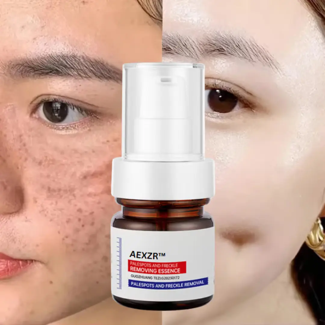 AEXZR™ Vitamin C Whitening Freckles Face Cream Remove Melasma Dark Spots Lighten Melanin