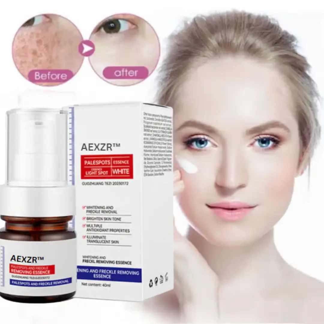 AEXZR™ Vitamin C Whitening Freckles Face Cream Remove Melasma Dark Spots Lighten Melanin