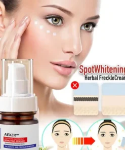 AEXZR™ Vitamin C Whitening Freckles Face Cream Remove Melasma Dark Spots Lighten Melanin