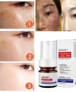 AEXZR™ Vitamin C Whitening Freckles Face Cream Remove Melasma Dark Spots Lighten Melanin