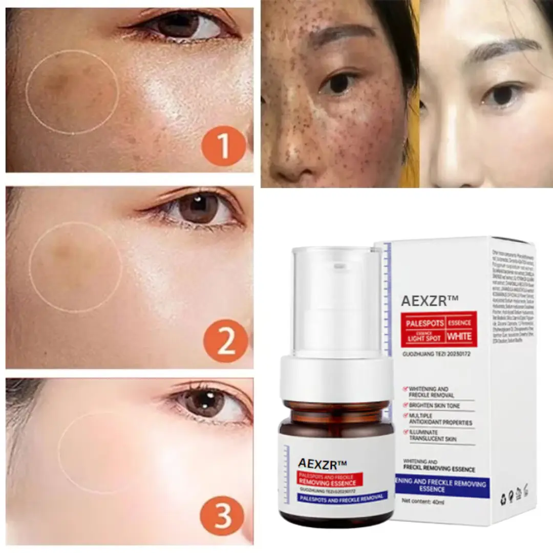 AEXZR™ Vitamin C Whitening Freckles Face Cream Remove Melasma Dark Spots Lighten Melanin