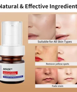 AEXZR™ Vitamin C Whitening Freckles Face Cream Remove Melasma Dark Spots Lighten Melanin