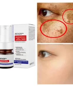 AEXZR™ Vitamin C Whitening Freckles Face Cream Remove Melasma Dark Spots Lighten Melanin