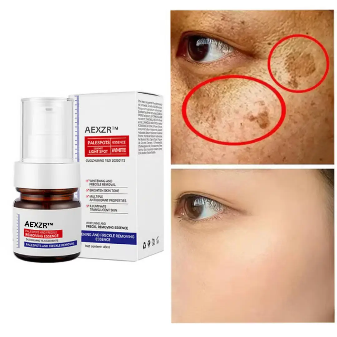 AEXZR™ Vitamin C Whitening Freckles Face Cream Remove Melasma Dark Spots Lighten Melanin