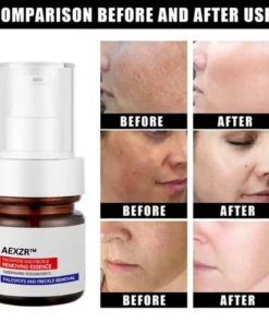 AEXZR™ Vitamin C Whitening Freckles Face Cream Remove Melasma Dark Spots Lighten Melanin