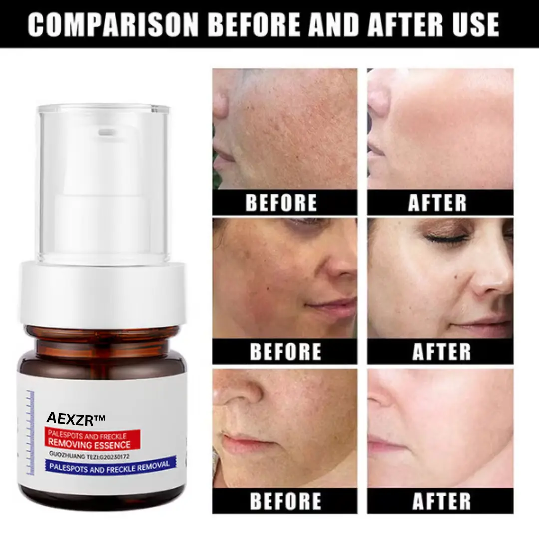 AEXZR™ Vitamin C Whitening Freckles Face Cream Remove Melasma Dark Spots Lighten Melanin