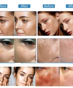 AEXZR™ Vitamin C Whitening Freckles Face Cream Remove Melasma Dark Spots Lighten Melanin