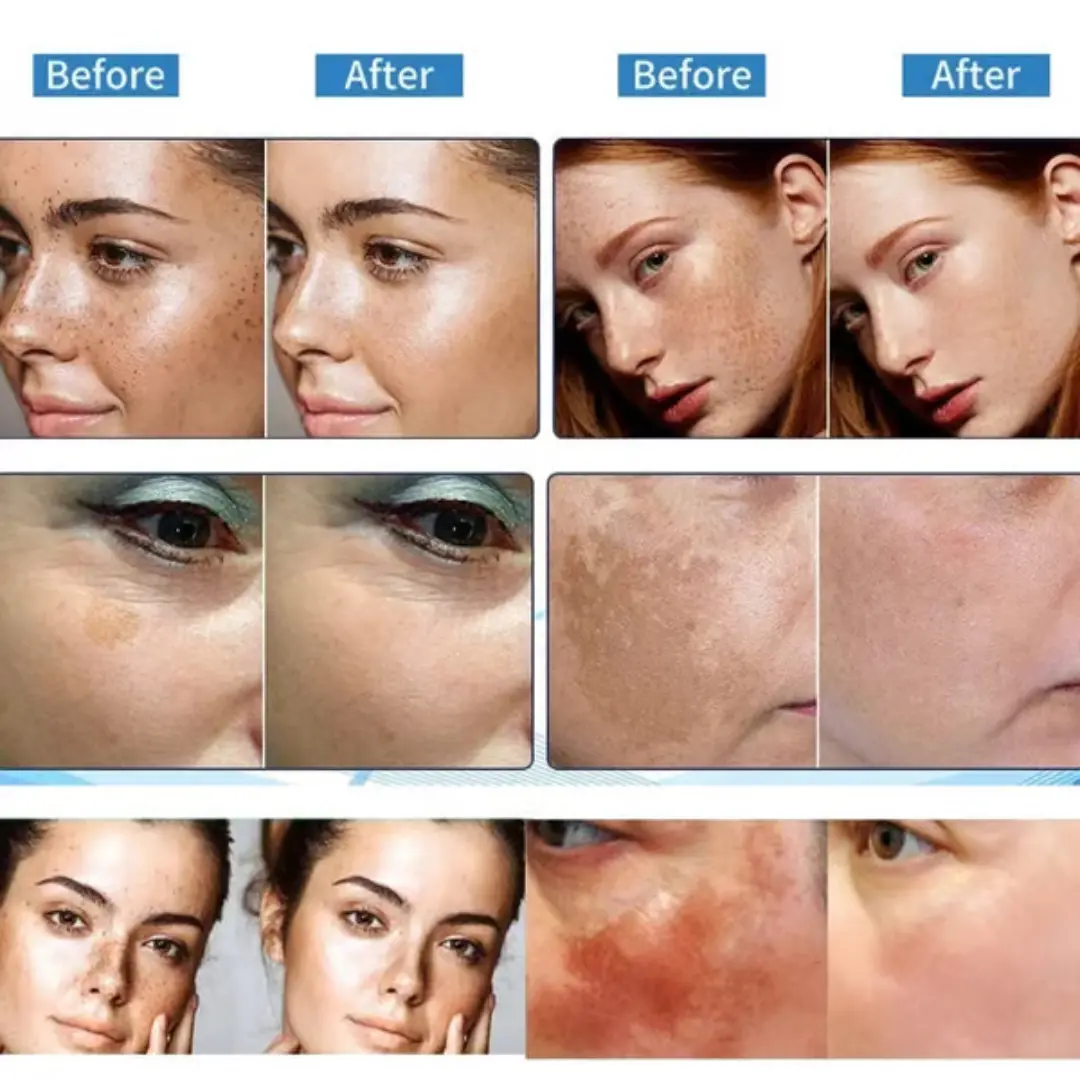 AEXZR™ Vitamin C Whitening Freckles Face Cream Remove Melasma Dark Spots Lighten Melanin