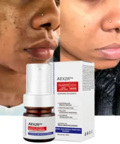 AEXZR™ Vitamin C Whitening Freckles Face Cream Remove Melasma Dark Spots Lighten Melanin