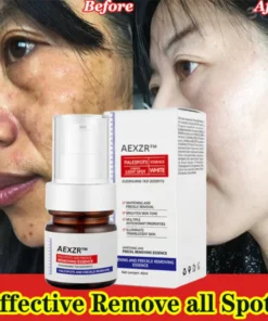 AEXZR™ Vitamin C Whitening Freckles Face Cream Remove Melasma Dark Spots Lighten Melanin