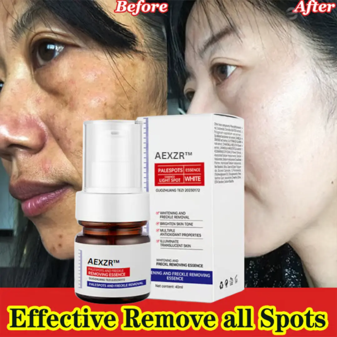 AEXZR™ Vitamin C Whitening Freckles Face Cream Remove Melasma Dark Spots Lighten Melanin