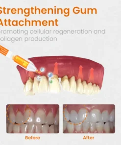 AEXZR™ Gum Repair Treatment Ampoules