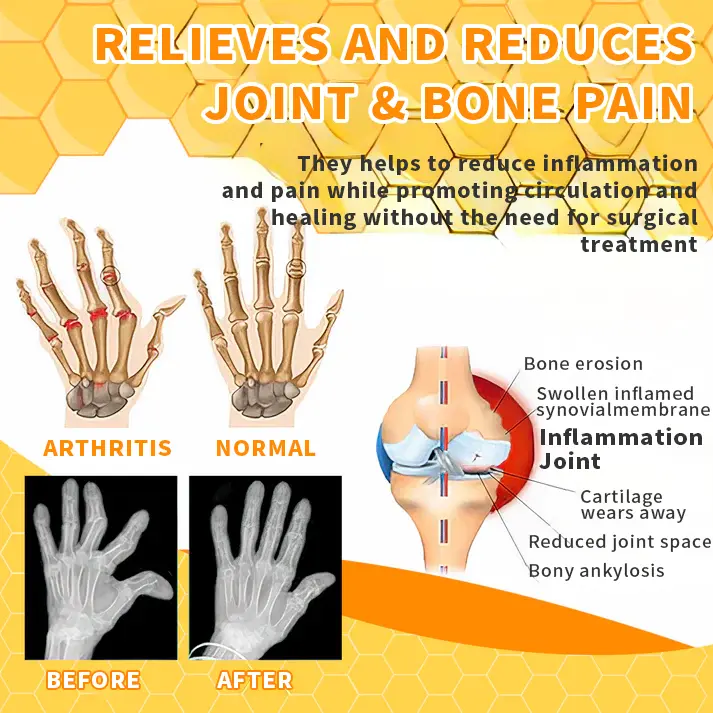 AQA™ Joint Therapy Pain Relief Gel