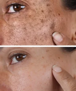 AQA™ Melanin Correcting Brightening Serum