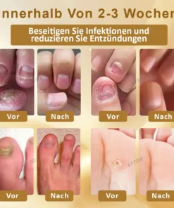 ATTDX™ Antimykotisches Mellifera Venom Reparaturserum