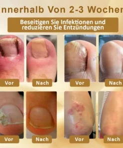 ATTDX™ Antimykotisches Mellifera Venom Reparaturserum