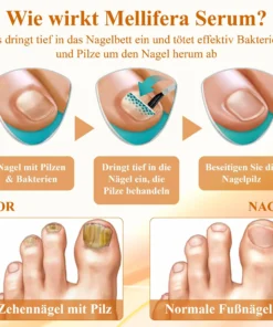 ATTDX™ Antimykotisches Mellifera Venom Reparaturserum