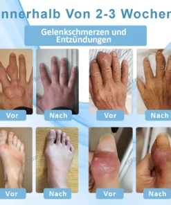 ATTDX™ Gicht Beruhigungs Kräuter Gelenk Entlastungspflaster