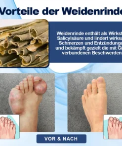 ATTDX™ Gicht Beruhigungs Kräuter Gelenk Entlastungspflaster