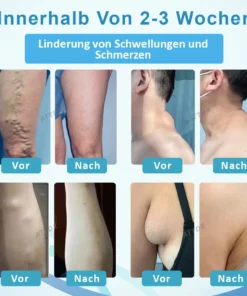 ATTDX™ LumpenKlar Lymphunterstützungs Roll-On