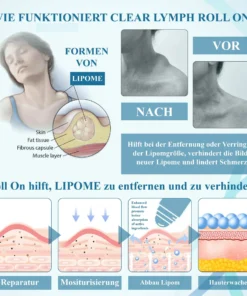 ATTDX™ LumpenKlar Lymphunterstützungs Roll-On