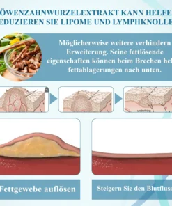 ATTDX™ LumpenKlar Lymphunterstützungs Roll-On