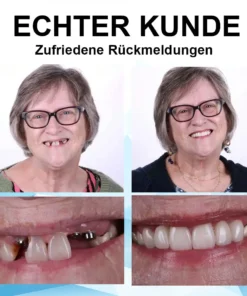 ATTDX™ Silikon Unterfütterungsset Zahnprothesen