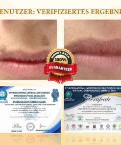 ATTDX™ Venomöse Apitherapie Tag und Muttermalentfernungspflaster