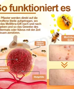 ATTDX™ Venomöse Apitherapie Tag und Muttermalentfernungspflaster