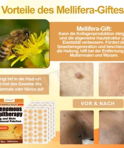 ATTDX™ Venomöse Apitherapie Tag und Muttermalentfernungspflaster