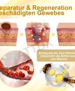 ATTDX™ Venomöse Apitherapie Tag und Muttermalentfernungspflaster