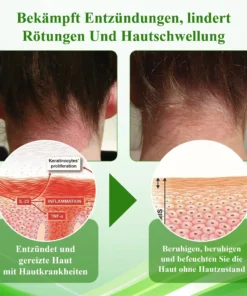 ATTDX™ Wiederauferstehungsgras Hautberuhigende