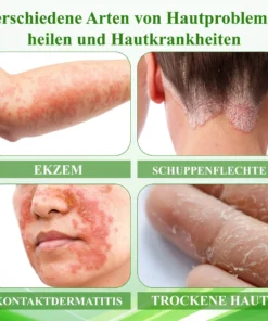 ATTDX™ Wiederauferstehungsgras Hautberuhigende