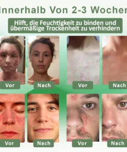 ATTDX™ Wiederauferstehungsgras Hautberuhigende
