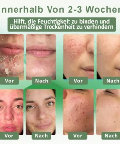 ATTDX™ Wiederauferstehungsgras Hautberuhigende