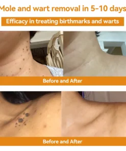 BSWELL™ Bee Venom Skin Treatment Cream